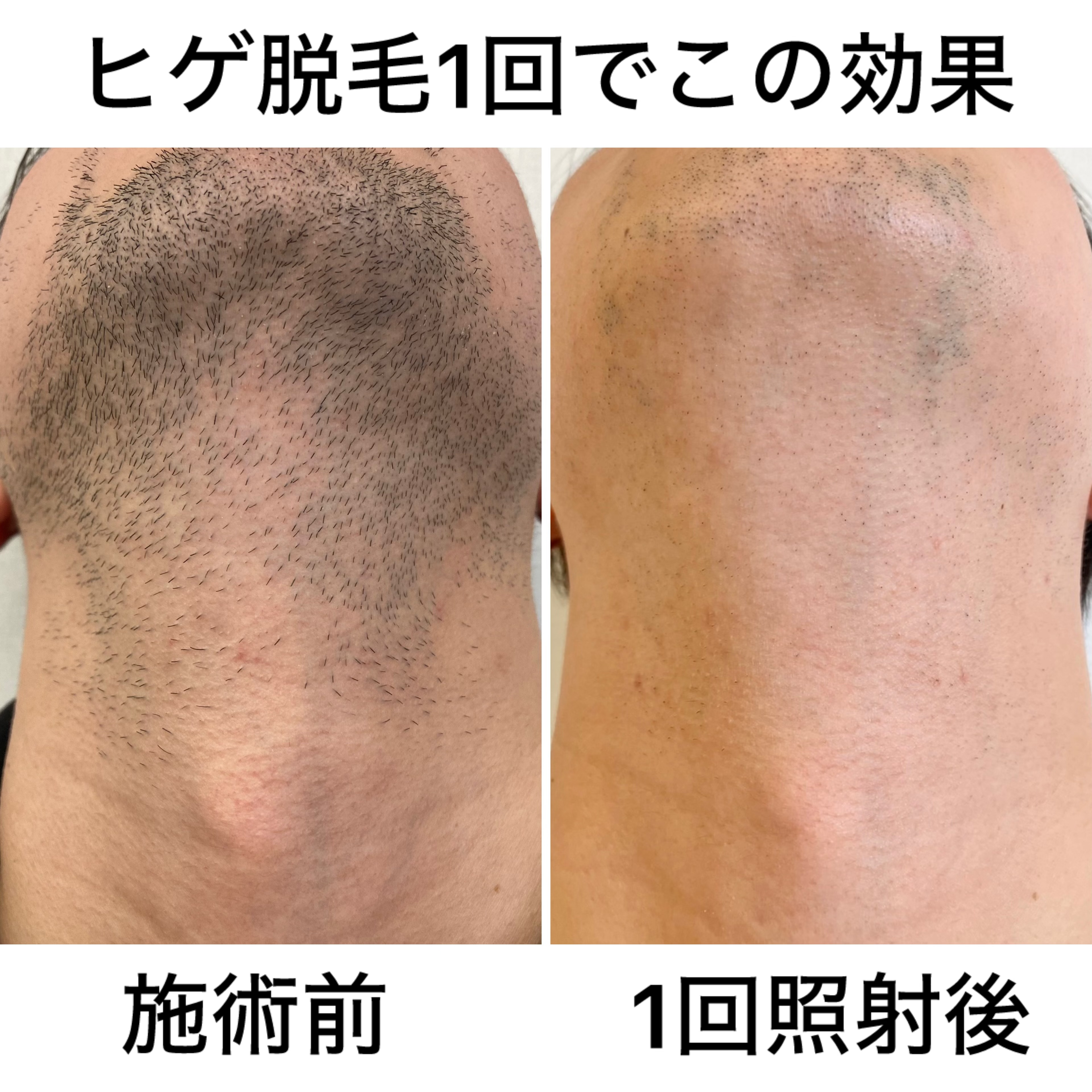 2. 効果実感を実感する理由