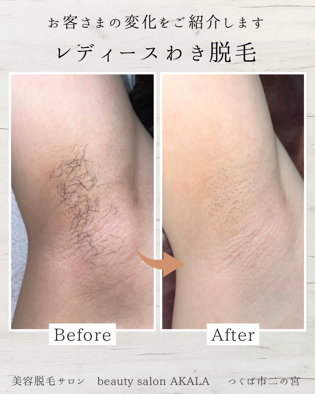 驚きのビフォーアフター