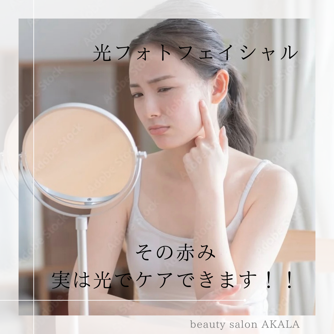 今すぐ予約！
