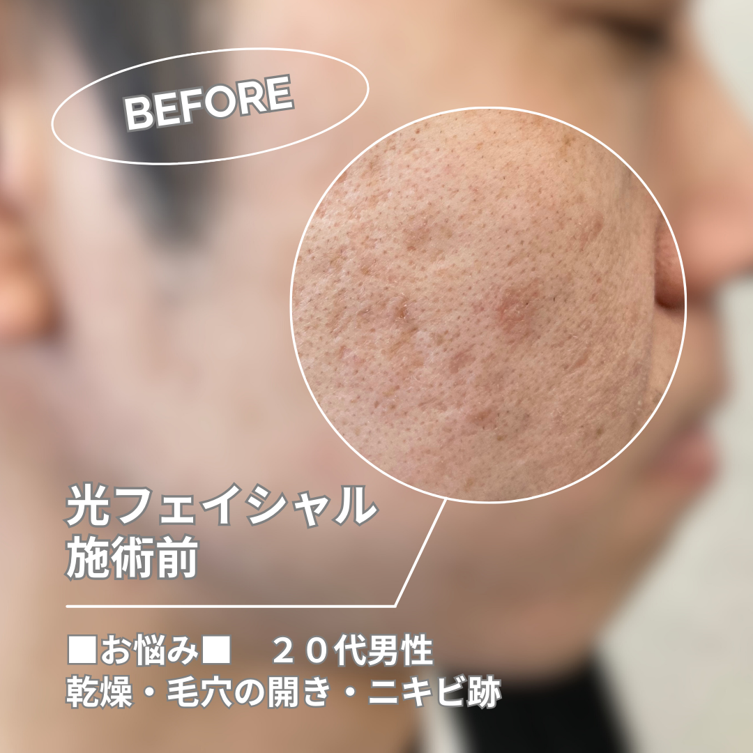 まずはお問い合わせを！
