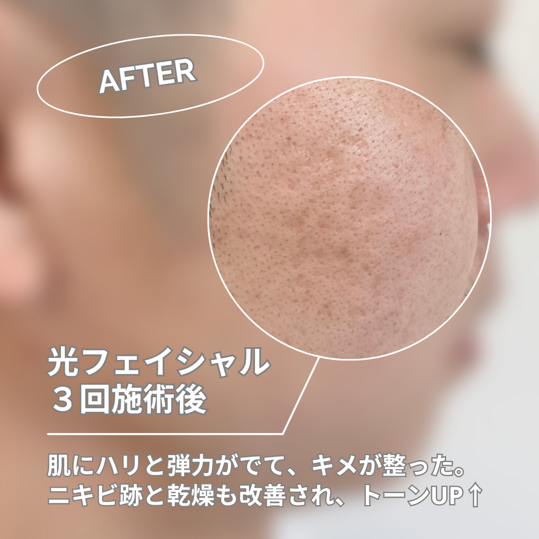 まずはお問い合わせを！