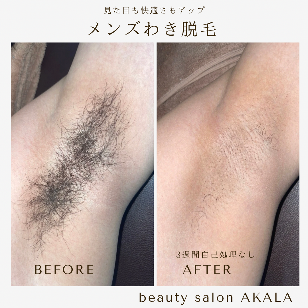施術メニューの柔軟性