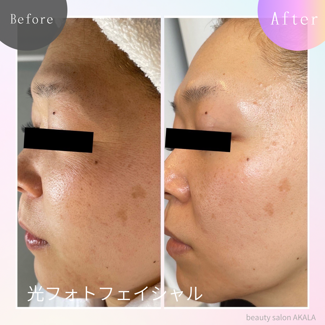4. 実際のお客様の体験談
