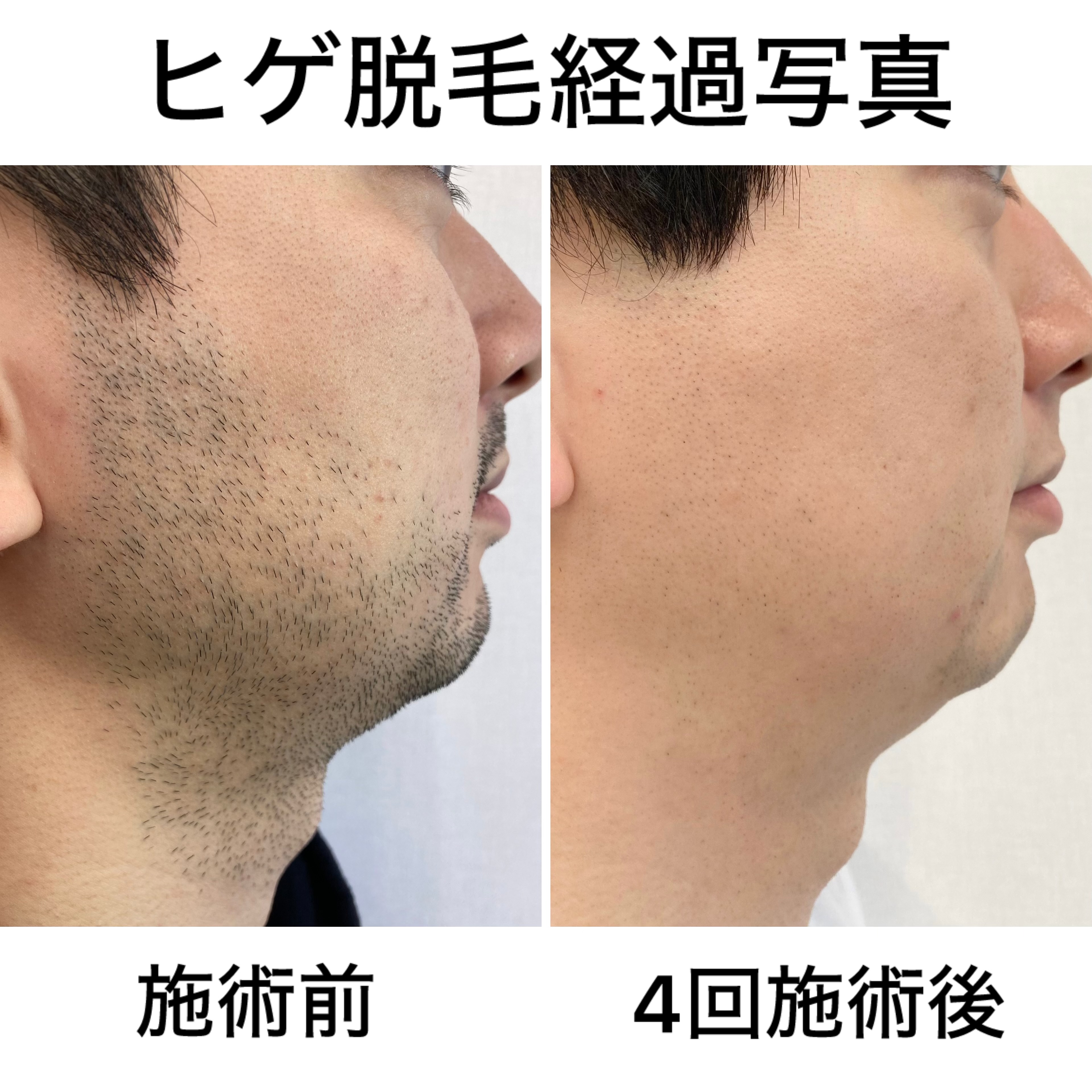 体験談：実際の声