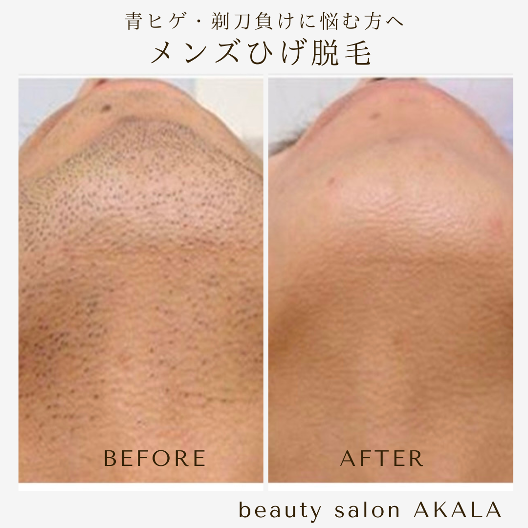 体験キャンペーンのご紹介